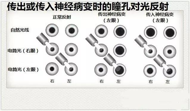 内脏分布图（内脏分布图 女士）