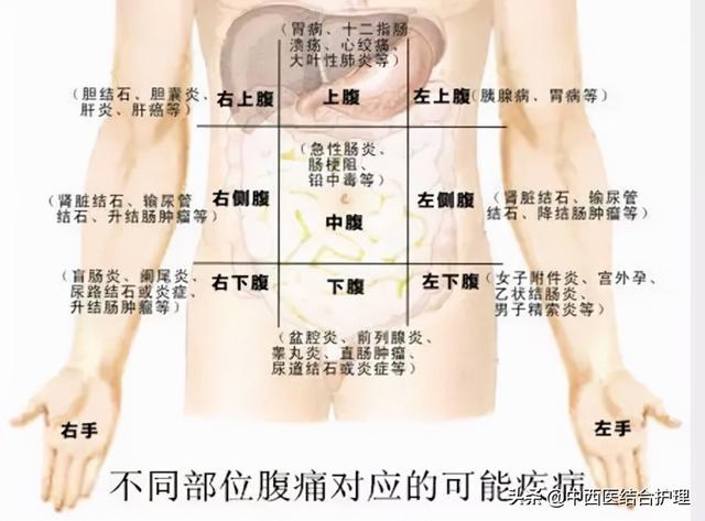 「腹痛诊断」腹部不同点的不同病，快来看一看吧